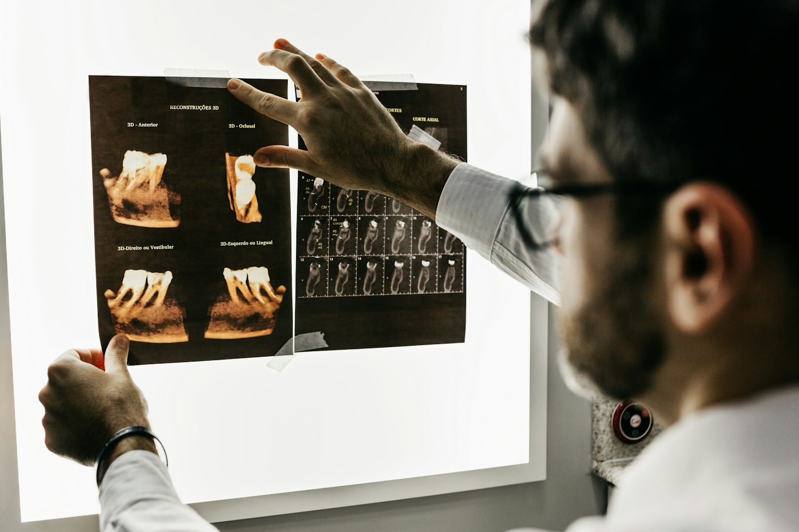 Dental implant treatment planning at Summit Dental